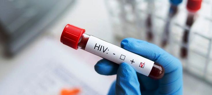 kasus HIV/AIDS
